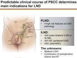 Image result for Penile Cancer