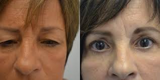 C. Jeff Kesler, MD, Board Certified Plastic Surgeon