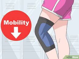 A hyperextended knee is where the knee joint bends too far backwards. 4 Ways To Fix Hyperextended Knees Wikihow