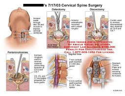 Pin On Cervical Spine