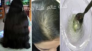 الوصفة المعجزة لانبات فراغات الشعر و الصلع في أسبوع أقسم بالله النتيجة ستبهرك ب4 مكونات فقط Youtube