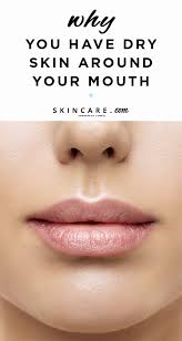 Derm Dms Why Do I Have Dry Skin Around My Mouth Skincare Com By L Oreal Dry Skin Causes Dry Skin Makeup Super Dry Skin