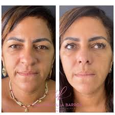 Dra Priscilla Barros