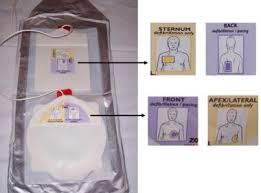 Image result for Transcutaneous Pacing