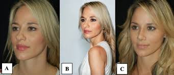 Impact of Artificial Intelligence (AI) Image Enhancing Filters