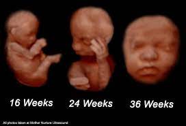 When Is The Best Time To Get A 3d Ultrasound Mother Nurture Ultrasound