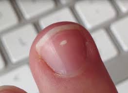 Doa ini dibaca ketika azan berkumandang, semasa muazzin sabda rasulullah: Punya 4 Macam Tanda Putih Ini Di Kuku Kamu Harus Waspada Citizen6 Liputan6 Com