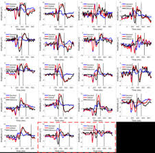 That, when perceptually novel stimuli are treated as members of a known category, they are processed more efficiently. Oddball Paradigm Wikipedia