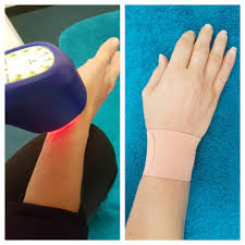 How do health care professionals diagnose tennis elbow? Forarm And Elbow Nerve Pain Down Arm Or Hand Perth Chiropractor Joondalup Perth Chiropractor Lakeside Chiropractic