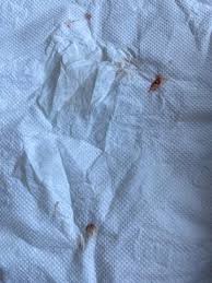 Ab Und Zu Blut In Spucke Spucken