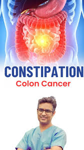 Image result for Constipation in Cancer