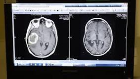 Image result