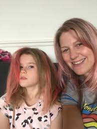 Girl with uncombable hair syndrome loves her looks