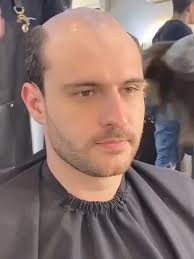 Prótesis Capilares: Estilo y Transformación en Reymon Studio