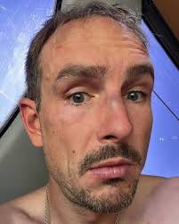 Comeback story from a past racing injury at knolls knockout race