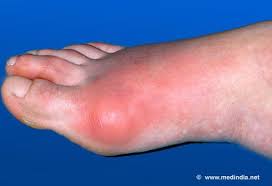 Pin On Body Problems
