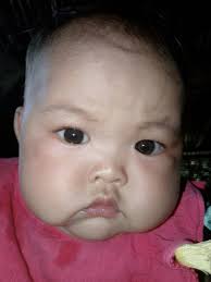 Hello po mga mi, ask ko lang po ano kaya pwde igamot sa mata ng baby na nag  mumuta? 7months old na po baby ko hindi nman po namumula mata nya nag