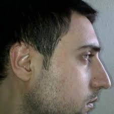 Ali Demirci (@AliiDemirci)