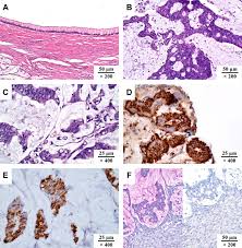 Image result for Pseudoeriosema