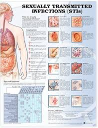 sexually transmitted infections stis chart unmounted