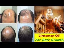 1/2 teaspoon of cinnamon powder. Pin By Tasha On Hair Growth Stages Hair Oil Hair Growth Oil Essential Oils For Hair