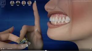 Teeth vore 5 - ThisVid.com