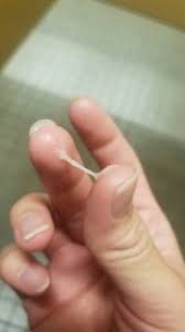 What exactly is vaginal discharge? Warning Pics Is The Cervical Mucus And Position A Sign Of Pregnancy Right Before Period Am I Pregnant Babycenter Australia