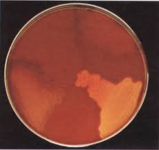 Image result for Group D Streptococcus