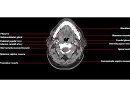 Furthermore, the pelvis protects the pelvic and abdominopelvic viscera. Ct Neck Axial Anatomy Radiologypics Com