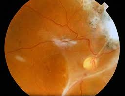 Image result for Chorisochora transvaalensis