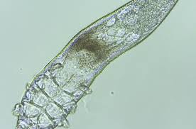 Image result for Demodex brevis
