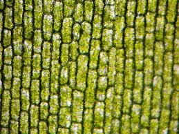 Red blood cells (rbcs) as seen under the microscope in isotonic, hypotonic and hypertonic solutions. Elodea In Hypotonic Or Isotonic Solution The Cell Cell Microscope