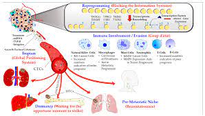 01.01.2017 · in prostate cancer, the classic definition of metastatic cancer is accompanied by the challenging scenario of patients who develop psa recurrence after definitive therapy as their only evidence of potential metastatic disease. Cancers Free Full Text How Prostate Cancer Cells Use Strategy Instead Of Brute Force To Achieve Metastasis