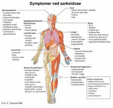 I tillegg forekommer misdannelser og utviklingsvarianter ved nyrer og urinveier som bør diagnostiseres tidlig for eventuell behandling. Norsk Sarkoidose Forening Added A Cover Norsk Sarkoidose Forening