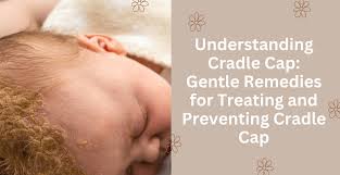 Image result for Cradle Cap