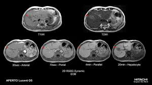 In some instances, mri may not be directly responsible for its administration. Aperto Lucent 0 4t Hitachi Medical Systems