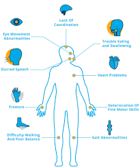 What Is Ataxia National Ataxia Foundation