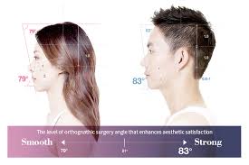 An orthodontist acquires complete records, including. Male Orthognathic Surgery In Korea Id Hospital Man S