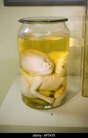 Preserved Unborn Baby In Jar At The Peter The Great Museum Of Anthropology And Ethnography St Petersburg Stock Photo Alamy