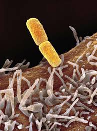 Image result for Shigella