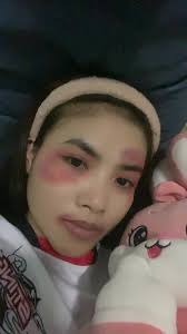 អរគុណបងដែលតែងតែមើលថែអូនទាំងឈឺទាំងជា បន្ទាប់ពីគ្រួសារអូនគឺបង@SAMNANG.Bo...