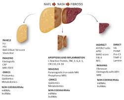 Image result for BARD Score