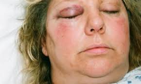 'I've had to learn to live again', says mother of three who was battered by  drunken thugs