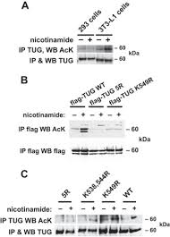 Cheung m, tai a, lu j and cheah kse. Acetylation Of Tug Protein Promotes The Accumulation Of Glut4 Glucose Transporters In An Insulin Responsive Intracellular Compartment Journal Of Biological Chemistry