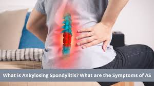 Feeling pain under you left ribs? What Is Ankylosing Spondylitis Types Symptoms Causes And Treatment