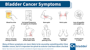 Recurrent urinary tract infections, or urinary tract symptoms, can be a sign of bladder cancer. Bladdercancer Me Bladdercancerme Twitter