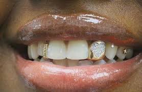 It is neither too soft nor too hard, and has the ability to fit your tooth with a precision that is unsurpassed. Swazilivesmatter On Twitter Y All Love Black Women With Gold Teeth Until It S Nthabiseng