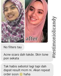 Selalunya pelanggan yang terlalu berkira dan nak dapatkan harga paling rendah pasti tertipu. Oli Candy Premium Gula Gula Pencerahan Kulit Original Murah Berkesan Tiptop Beauty Shop Murah