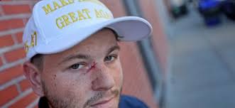 Someone might want to tell the people with the trump flags jumping in  traffic by Water/Main st that the election was Tuesday.