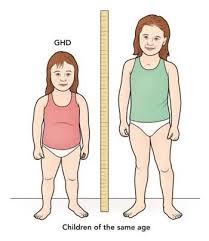 Growth disorders